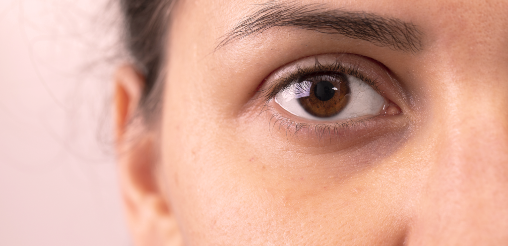 Tratamentos estéticos para olheiras como a drenagem linfática facial