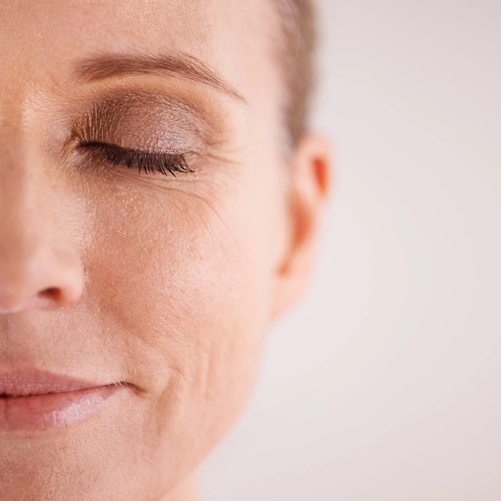 Mulher madura de olhos fechados durante avaliação facial para tratamento com Ultraformer MPT